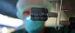radiografia-odontologia-caxias-1394915798